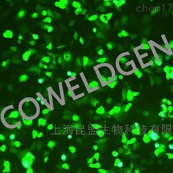 KMCC-003249-GFPHCT116-GFP 人结肠癌细胞（GFP标签）