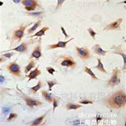 组织免疫组化（IHC）