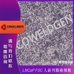 KMCC-001-0017LNCaP FGC 人前列腺癌细胞