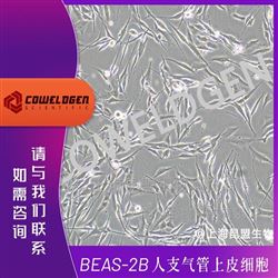 KMCC-001-0354BEAS-2B 人支气管上皮细胞